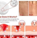Skin Tag Remover Patch