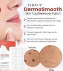Skin Tag Remover Patch