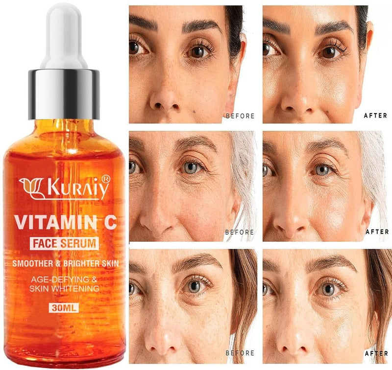 Kuraiy Orange  Face Serum - Skin Brightening Serum , Anti-aging, Skin Repair, Supercharged Face Serum, Dark Circle, Fine Line & Sun Damage Corrector Face Serum -30 Ml