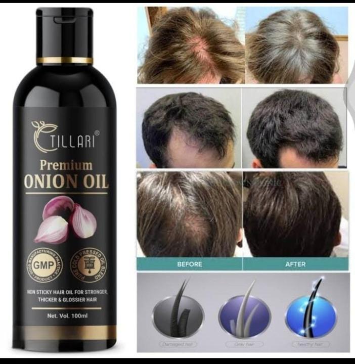 Ayurvedic Premium Onion Hair Oil Pack Of 1