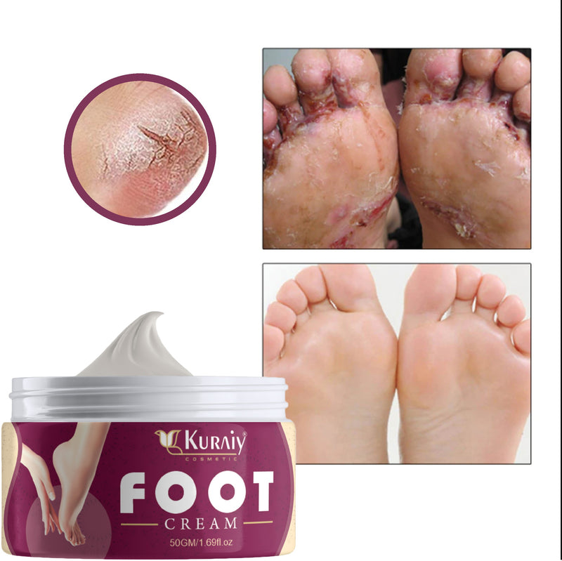 Kuraiy Crack Blaster Repair - Cracked Skin, Heel, Finger Healing Balm And Crack Blaster Revive Dry Skin And Body Cream (50gm)