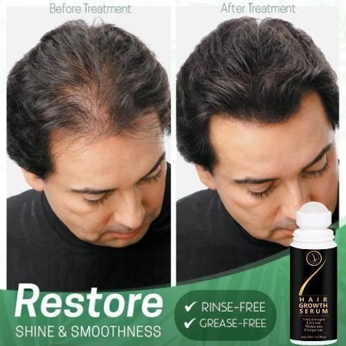 Hair Serum For Hair Growth Serum For Damaged & Dry Hair 45ml Pack Of 2