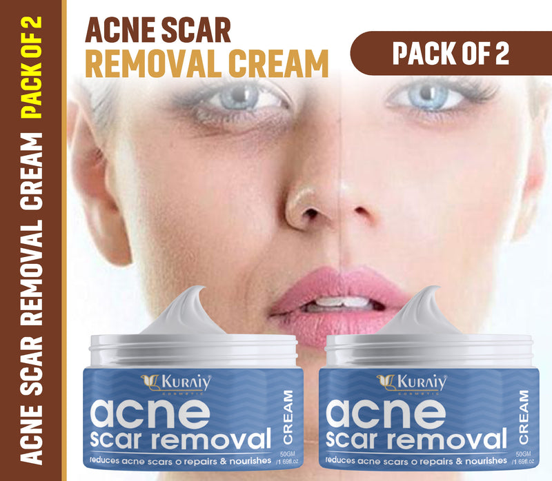 Kuraiy Scar Removal Cream Repair Stretch Marks Burn Acne Surgical Acne Scar Ointment Herbal Treatment Gel Whitening Pack Of 2